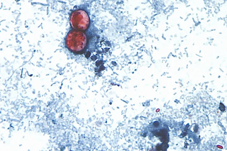 Michigan reports first 2 US deaths related to diarrhea-causing parasite